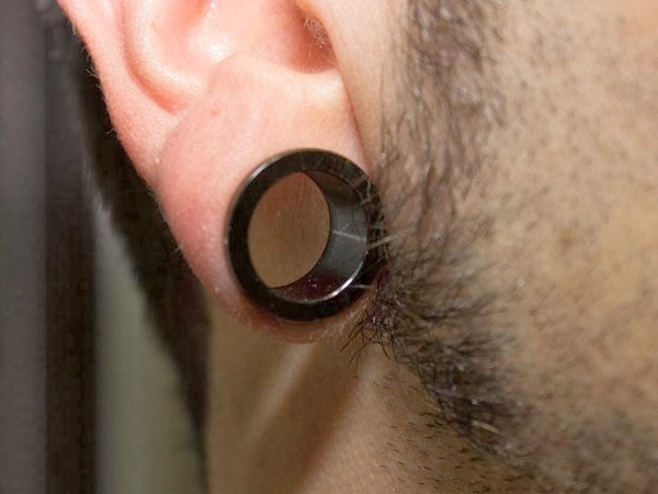 Dilatación de Lóbulos de 0 a 6 mm (Procedimiento de una oreja) 