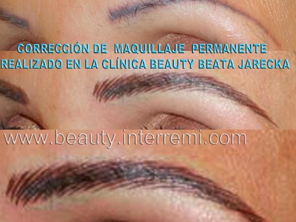 Imagen micropigmentacion-medica-marbella.blogspot.com. Todos los derechos reservados 